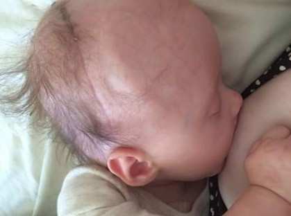 Breastfeeding Baby Undergoing Chemo Goes Viral